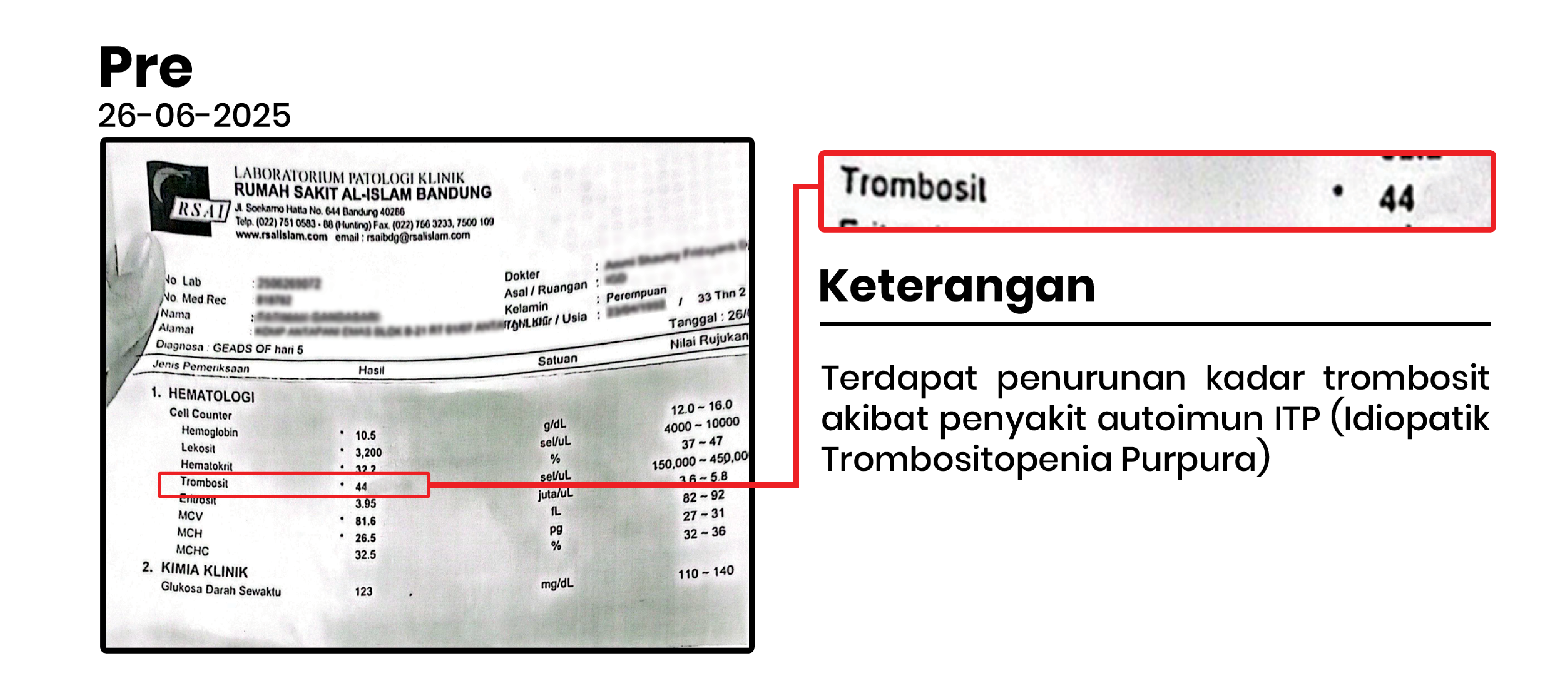 Hasil pemeriksaan sebelum program ITP